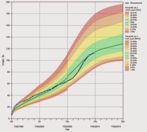 Growth chart showing a teen who fell off their growth curve and may have developed anorexia